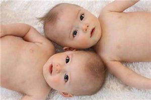 孕婦夢見雙胞胎_周公解夢 孕婦夢見雙胞胎是什麼意思_孕婦夢見雙胞胎好不好_周公解夢官網