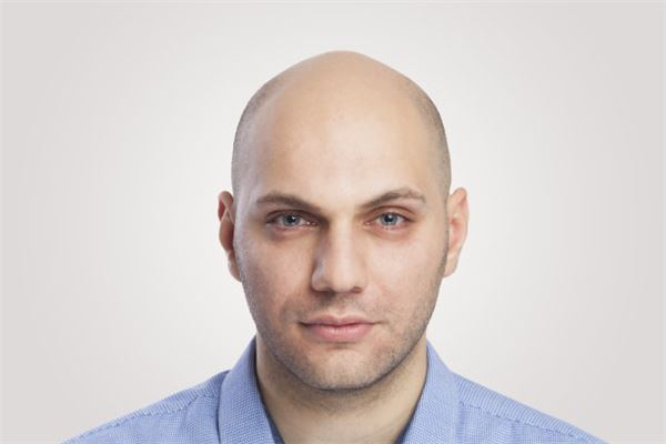 夢見禿頂_周公解夢