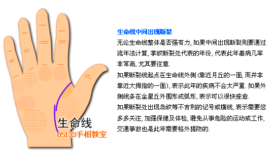 生命線圖解 生命線分叉(2)