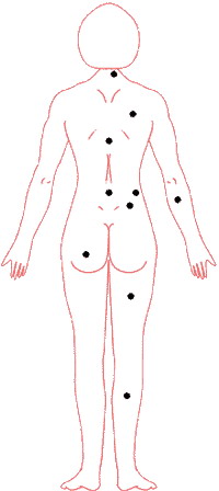 痣的位置與命運圖：02、痣相吉凶速查 點痣必讀要訣_看相大全