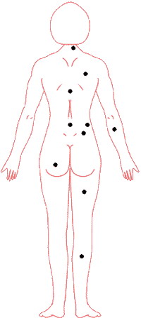 痣的位置與命運圖：02、痣相吉凶速查 點痣必讀要訣_看相大全