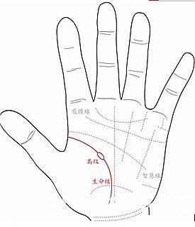 什麼樣的手相，較容易有疾病纏身？