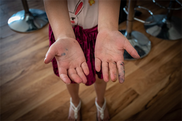 夢見手開裂什麼寓意_周公解夢