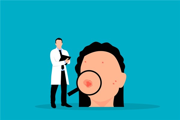 夢見臉上起痘痘有何寓意_周公解夢