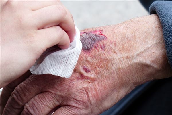 夢到別人流血_周公解夢