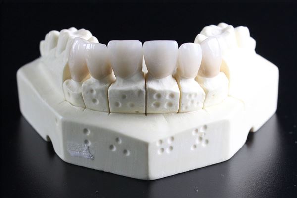 夢見自己掉牙一大排_周公解夢