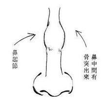 竹節鼻