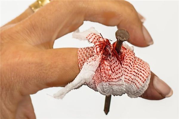 夢見自己手受傷了是怎么回事_周公解夢