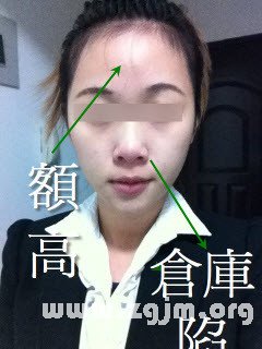額頭高