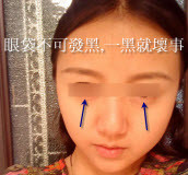 臥蠶顏色