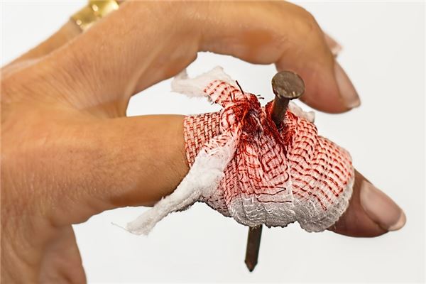 夢見受害是怎麼回事_周公解夢