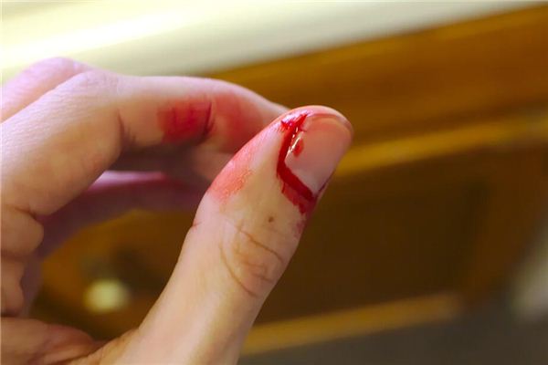 夢見手破了_周公解夢