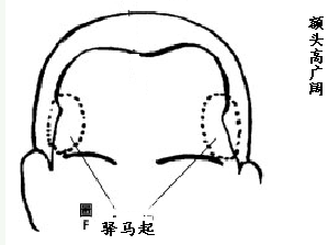 面相額頭圖解