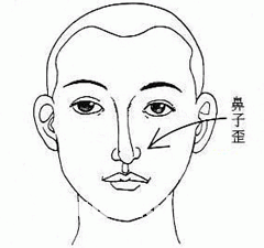 歪鼻的人命運好嗎？