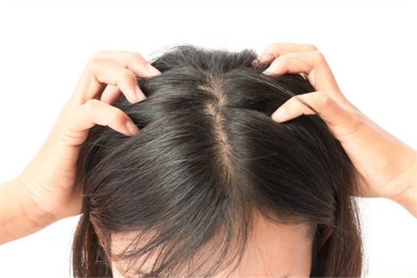 夢到頭上長虱子並掐死_周公解夢