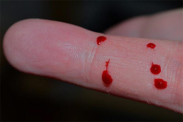 夢到滴血是好的徵兆嗎_周公解夢