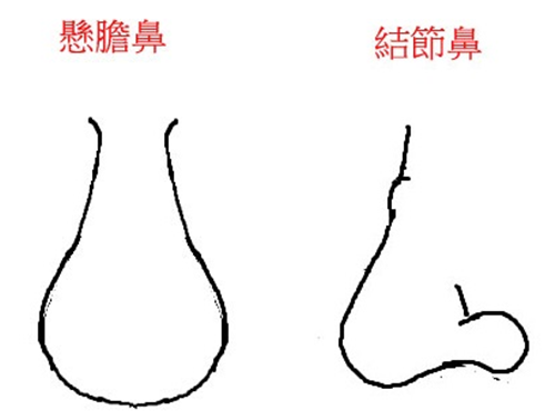 懸膽鼻能發財