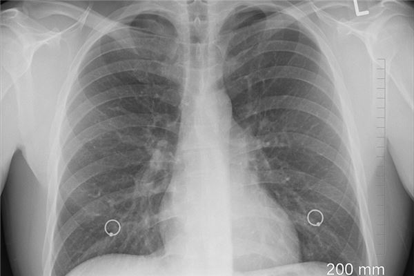 夢到了五臟代表什麼_周公解夢