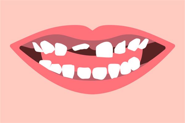 做夢牙碎了_周公解夢