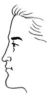 直面型