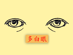 眼睛:多白眼