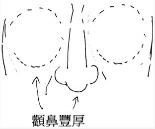 顴豐鼻厚