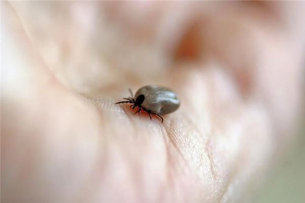 夢見拔出寄生蟲_周公解夢