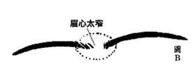 交連眉