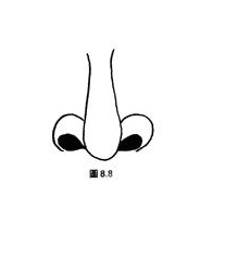 豬膽鼻
