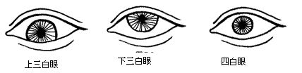 三白眼