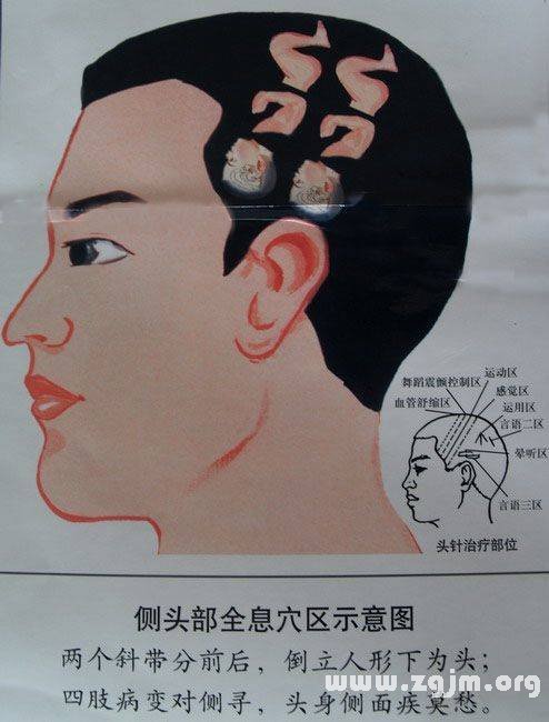 側頭全息穴位示意圖