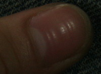 指甲上面有橫紋