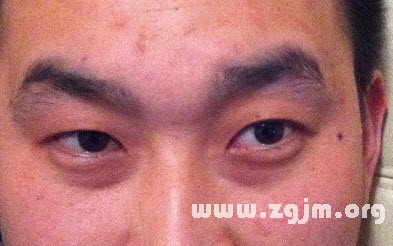 夫妻宮有黑痣