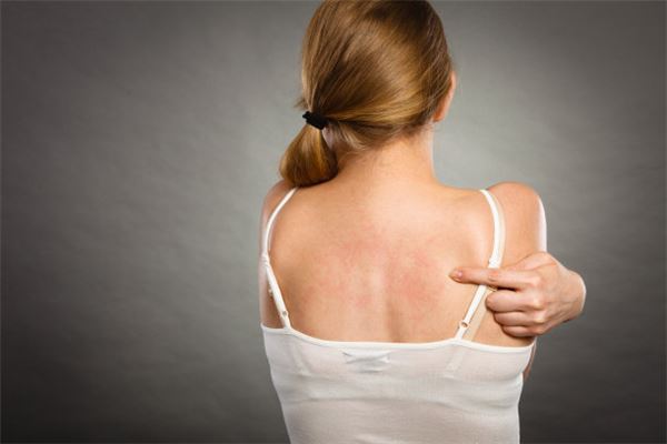 夢見身上長瘡_周公解夢