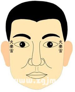 太陽穴有青筋代表什麼