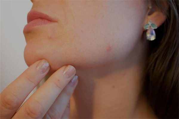 夢見紅點有什麼徵兆_周公解夢