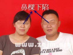 婚配男女臥蠶發黑