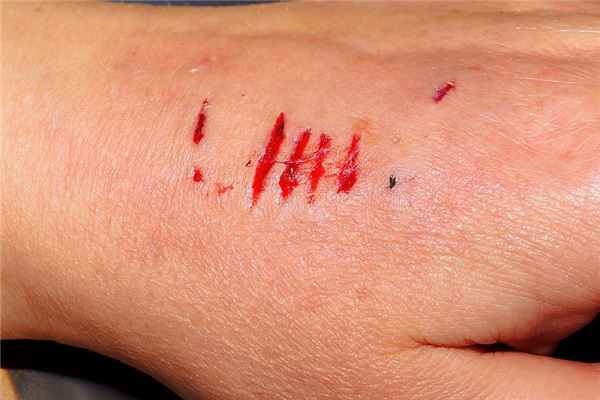 夢見狗被咬傷出血_周公解夢