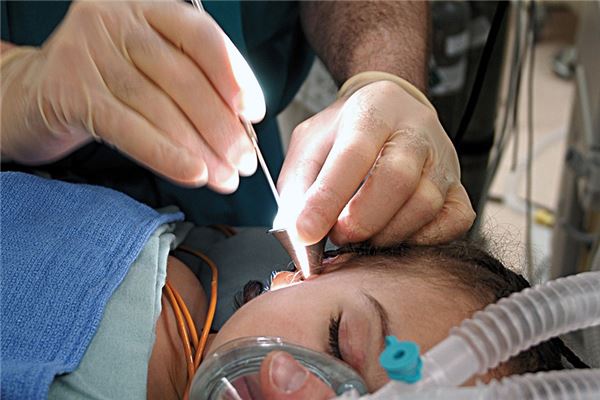 夢到好多耳屎意味著什麼_周公解夢
