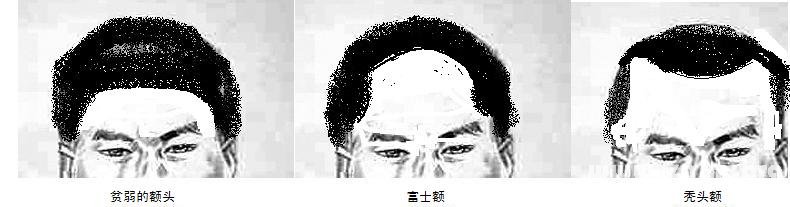 額頭