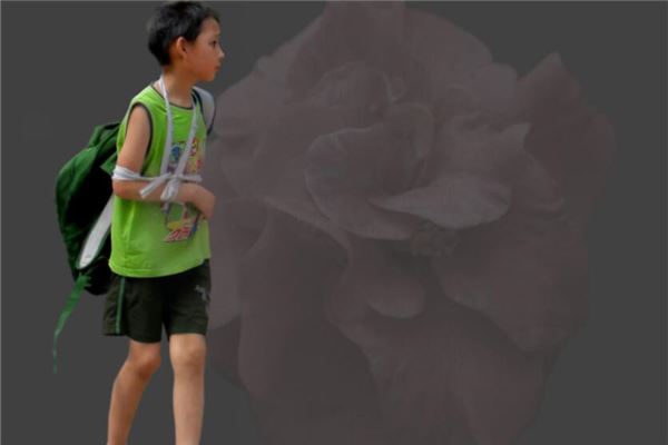 夢見兒子受傷嚴重_周公解夢