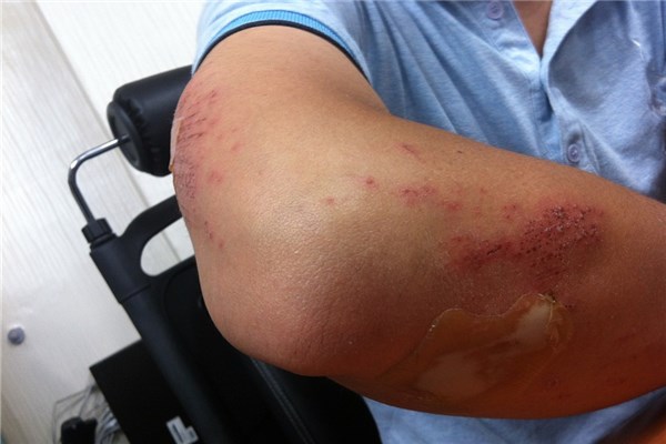 夢到了家裡人出事什麼寓意_周公解夢