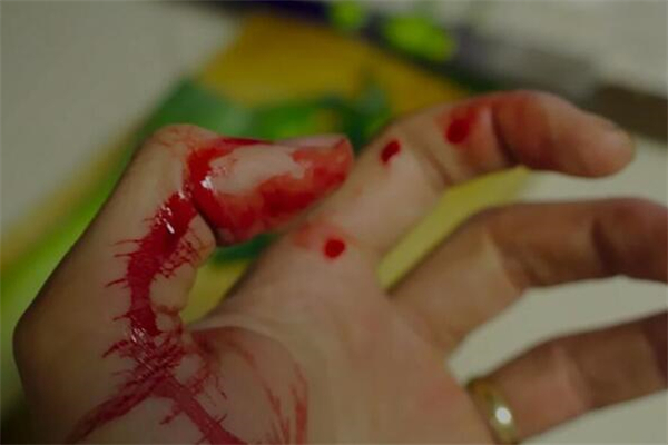 夢到刺傷是什麼徵兆_周公解夢