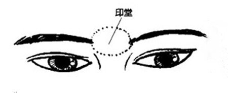 印堂凹陷面相解析