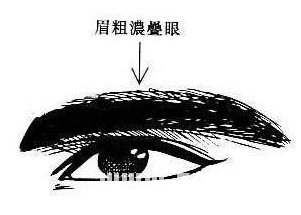 重壓眉
