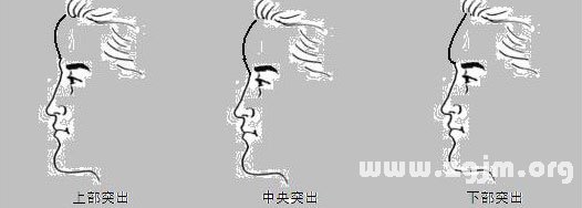 突出的額頭