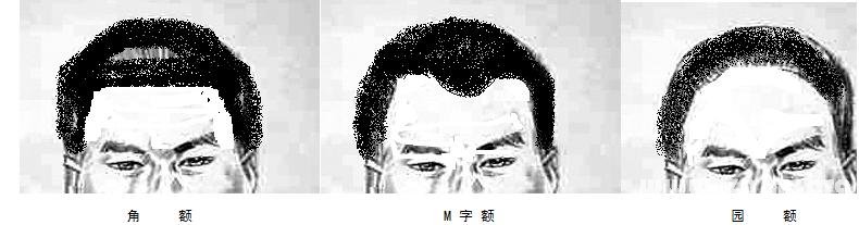 額頭