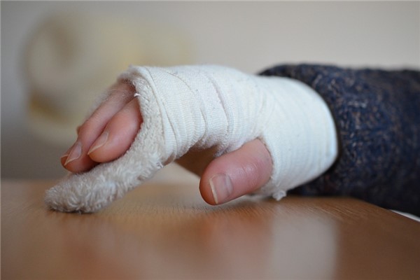 夢到別人手斷有什麼預示嗎_周公解夢