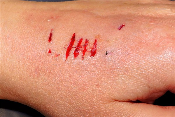 夢到了被狗咬到手指預示著什麼_周公解夢