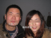 婚配男女眼下都有臥蠶